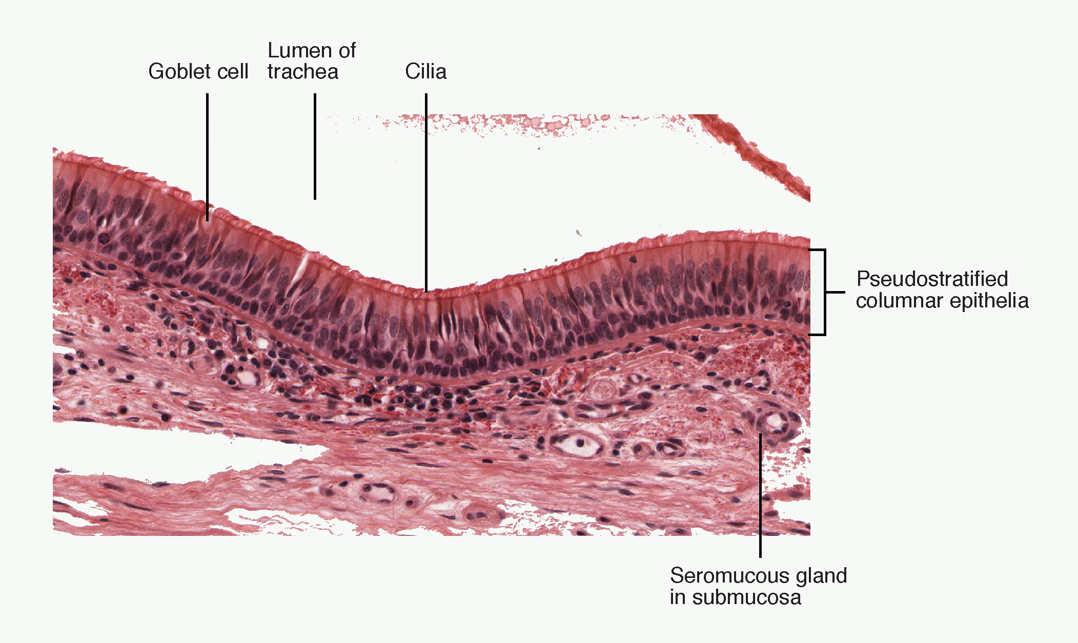 Pseudostratified ciliated columnar respiratory epithelium with goblet cells and mucus movement.