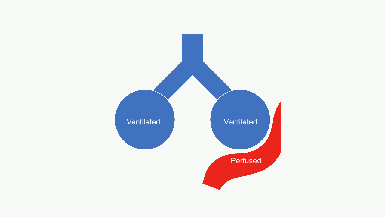 Alveolar dead-space diagram showing ventilation without effective perfusion.
